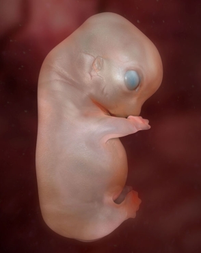 Human being?  Not even a potential dog (its a puppy foetus)